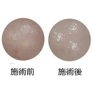 メナードフェイシャルサロン丸の内ヒルズ所属・メナード丸の内ヒルズ 柳田りさのエステ・リラクイメージ