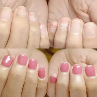 ネイル 深爪矯正/爪育成ケア manie nailのネイルデザイン