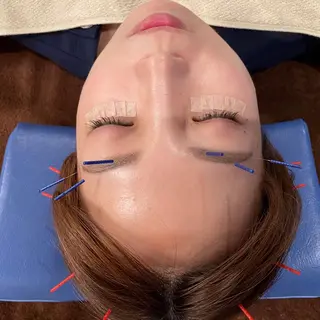 美容鍼　蒼月-aotsuki-所属・美容鍼「蒼月」 -アオツキ-のエステ・リラクイメージ