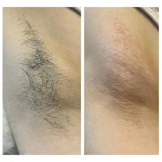 ぷーな シュガーリング竹ノ塚のエステ・リラクイメージ