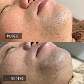 メンズ 脱毛専門サロン BELFINE恵比寿のエステ・リラクイメージ