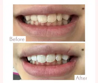 セルフホワイトニングエクシア小山店所属・セルフホワイトニング エクシア小山店のその他イメージ