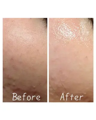 肌質改善Charme coco  増毛のエステ・リラクイメージ