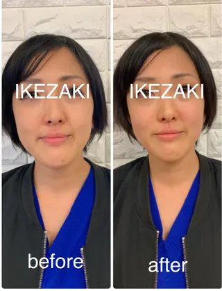 美容鍼 IKEZAKIのエステ・リラクイメージ
