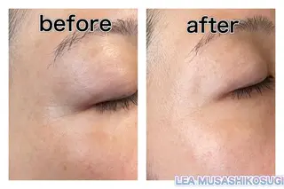 LEA MUSASHIKOSUGI所属・美肌育成サロン LEA武蔵小杉のエステ・リラクイメージ