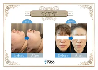 毛穴/肌質改善サロン クレアベレッツァのエステ・リラクイメージ