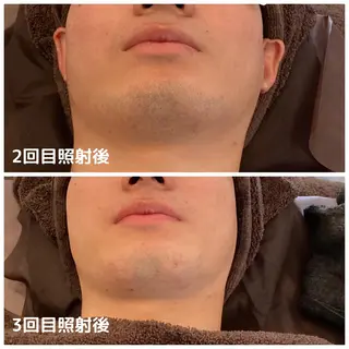 メンズ メンズ脱毛ECXIA所属・men's脱毛サロン ECXIAのエステ・リラクイメージ