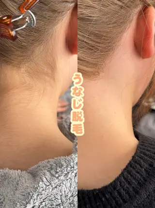 Hit. シュガーリング豊橋のエステ・リラクイメージ