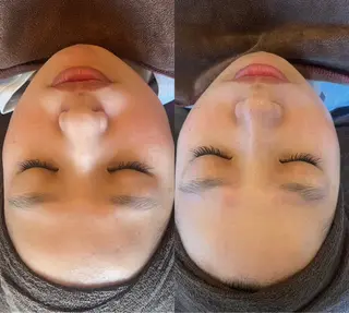 oyam オヤムのエステ・リラクイメージ