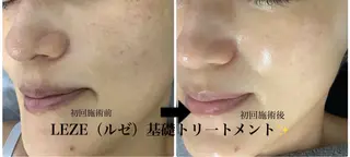 🩵Tatsumi Kana🩵のエステ・リラクイメージ