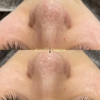 マツエク・マツパ ビューティー ミロワールのエステ・リラクイメージ