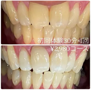 PLATINUM Beauty 横浜店所属・ホワイトニングルーム 横浜店のその他イメージ