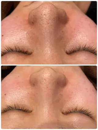 Fleur フルールのエステ・リラクイメージ