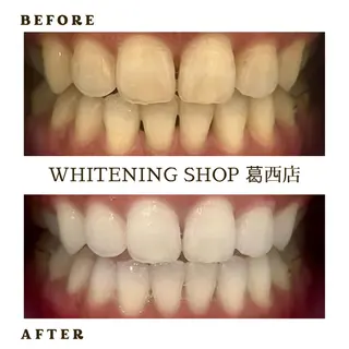 メンズ ホワイトニング ショップ葛西店のその他イメージ