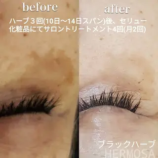 オールハンド フェイシャルのエステ・リラクイメージ