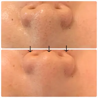 luana beauty所属・kana ハーブピーリング🌿のエステ・リラクイメージ