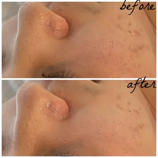 メンズ メナード岐阜市茜部 杉浦のエステ・リラクイメージ