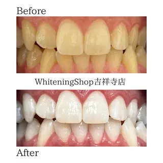 ホワイトニング ショップ吉祥寺店のエステ・リラクイメージ