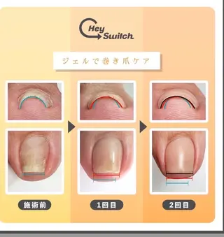 小顔と腸の専門店 ラクーラビューティのエステ・リラクイメージ