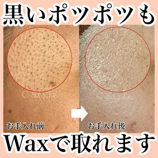 エステサロン C- S.t.y.l.e.のエステ・リラクイメージ