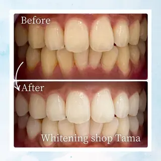 ホワイトニング ショップ多摩店のその他イメージ