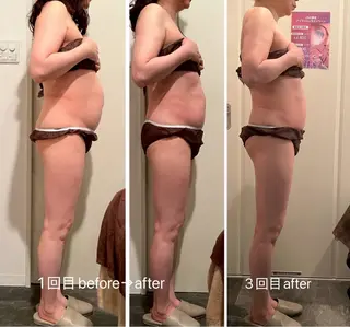 痩身/リラク 🎀KOZUKAのエステ・リラクイメージ