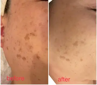 L'amour 御徒町所属・L'amour御徒町 🎀MoMo🎀のエステ・リラクイメージ