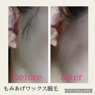 Lutella所属・ワックス脱毛専門店 Lutellaのエステ・リラクイメージ