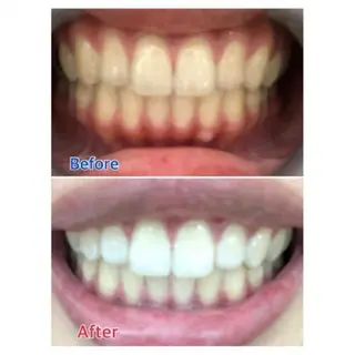 M渋谷店所属・Ｍ渋谷 ホワイトニングのエステ・リラクイメージ