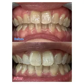 MBEAUTYSALON 千葉店・京成大久保所属・Melty 輝のその他イメージ