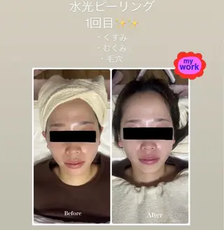 脱毛サロン エクボスタッフのエステ・リラクイメージ