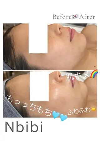 韓国🇰🇷価格 サロン_Nbibiのエステ・リラクイメージ