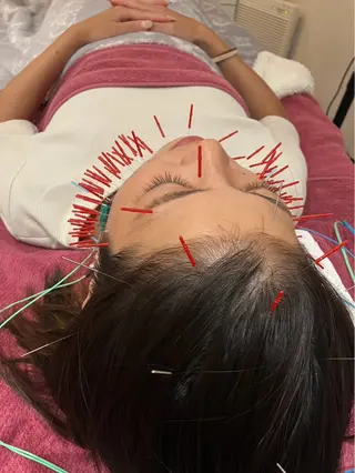 美容鍼灸女性専用 りんご鍼灸治療院のその他イメージ