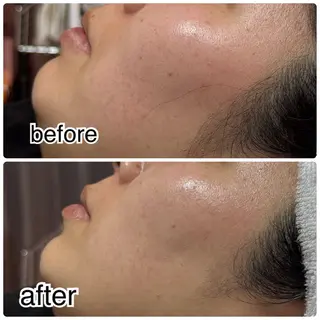 ROR所属・ROR nailのエステ・リラクイメージ