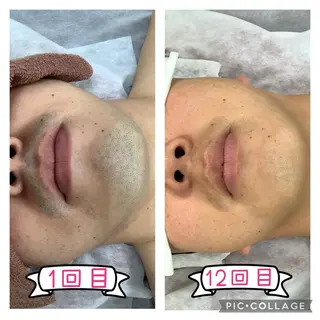 メンズ REONZ取手店所属・REONZ 取手店のエステ・リラクイメージ