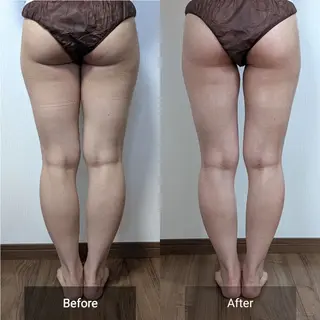 nail RiRi アトレナチュラのエステ・リラクイメージ