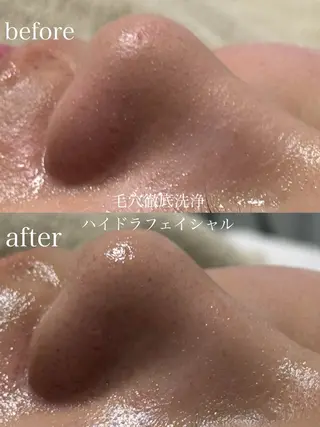 フェイシャルサロン CHIARA鈴木のエステ・リラクイメージ