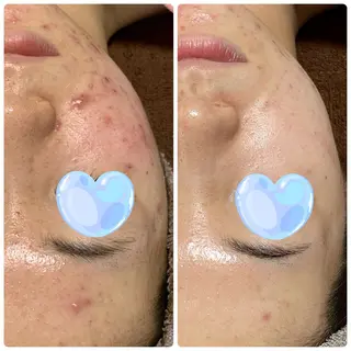 M.riche エムリシェのエステ・リラクイメージ