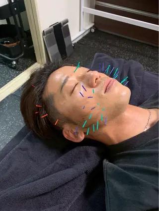 美容鍼・小顔矯正 FLOW 鍼灸整体院のその他イメージ