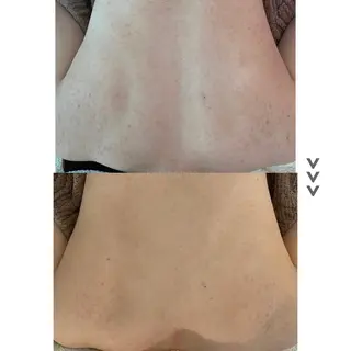 肌質改善 KALANCHOEのエステ・リラクイメージ