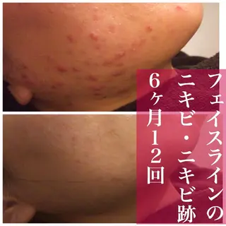 ミディアム カラー パーマ ヘアアレンジ メンズ キッズ ネイル マツエク・マツパ アイブロウ ニキビ・肌質改善専門 ♡人生が変わるサロンのエステ・リラクイメージ