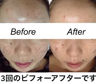 セミロング カラー パーマ ヘアアレンジ ネイル マツエク・マツパ 都度払い肌質改善 &脱毛Blancheのエステ・リラクイメージ