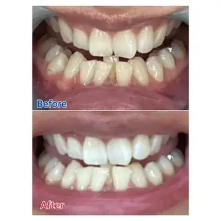 M渋谷店所属・M渋谷 ホワイトニングのエステ・リラクイメージ