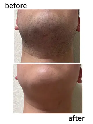 メンズ PROSOL こころのエステ・リラクイメージ