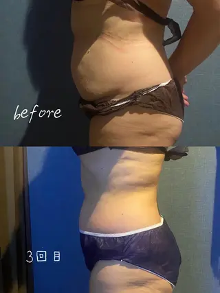 🧚‍♀️優来 リラク痩身肌質改善のエステ・リラクイメージ