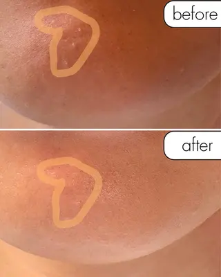 蝶式糸除毛専門salon aco所属・糸除毛専門salon acoのエステ・リラクイメージ