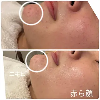 ilima NARUMIのエステ・リラクイメージ