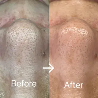 Blue Moon 【ブルームーン】のエステ・リラクイメージ