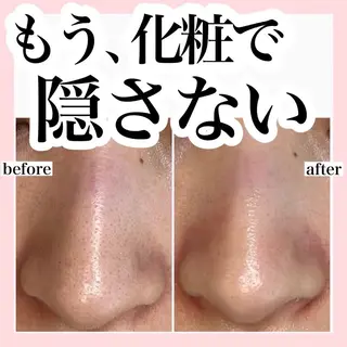 ハーブピーリング/ ララピール専門店のエステ・リラクイメージ