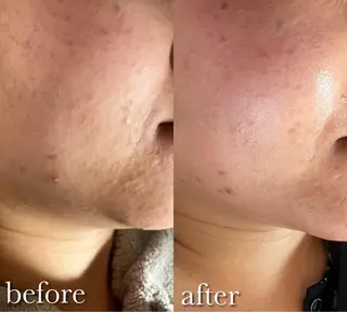 Luana  アイラッシュ& フェイシャル所属・Luana eyelashのマツエク・マツパデザイン